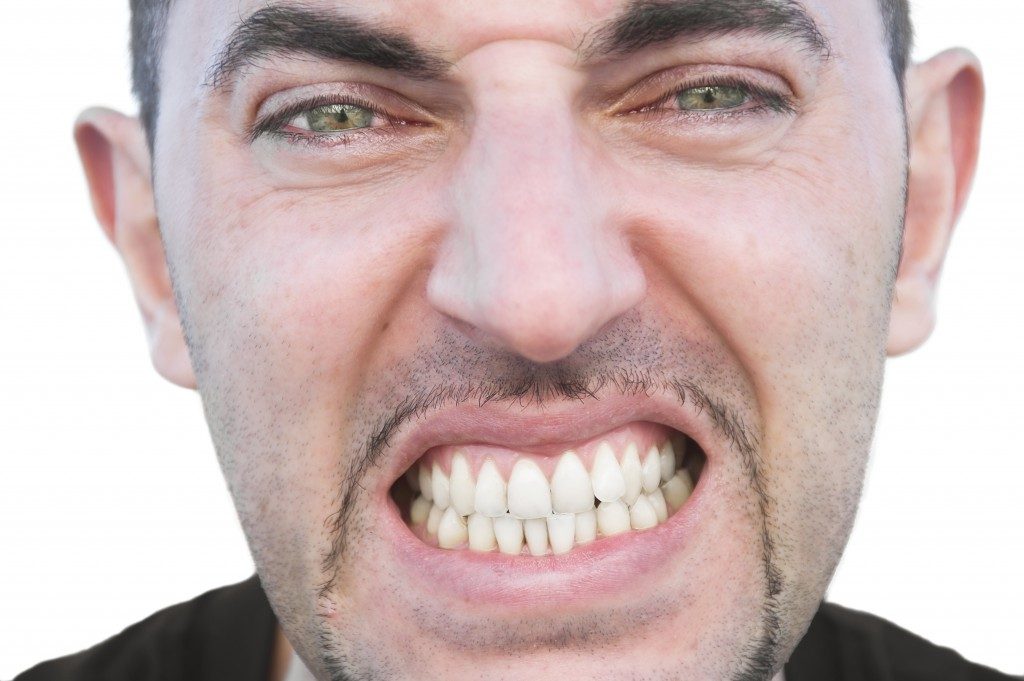 Man showing his misaligned teeth
