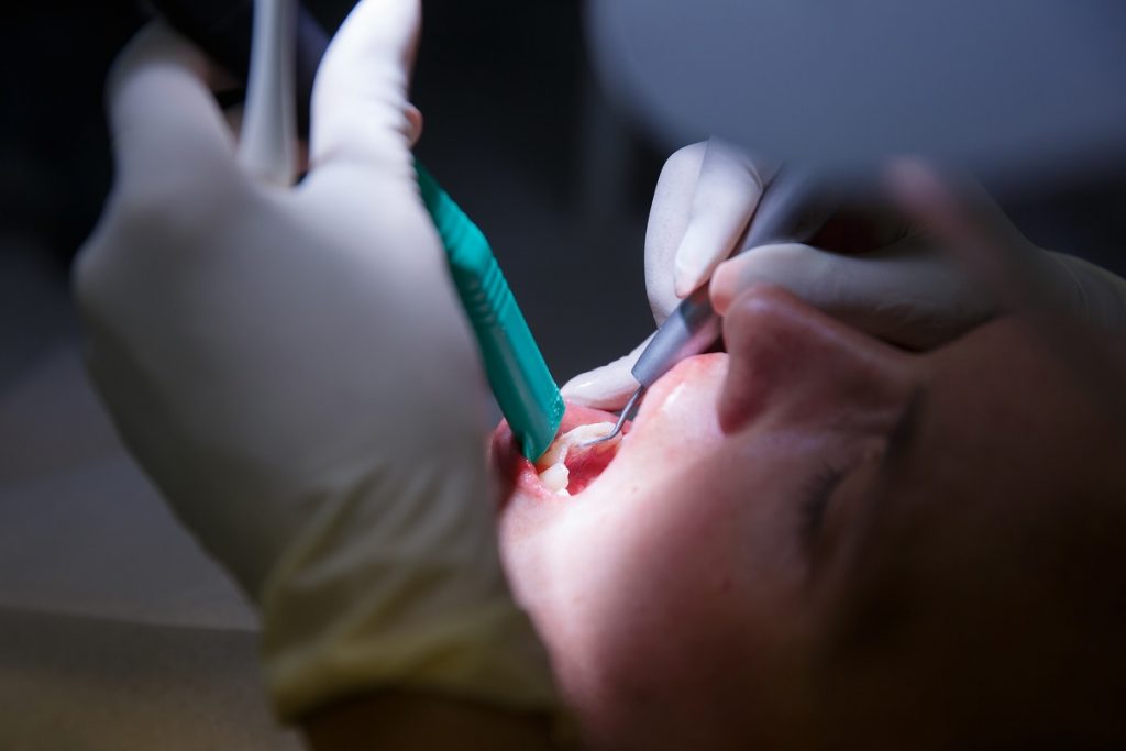 woman having a dental examination